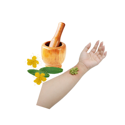 Ramuan tradisional Memar dari St. John's Wort