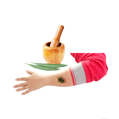 Ramuan tradisional Bisul dari Soka Hutan