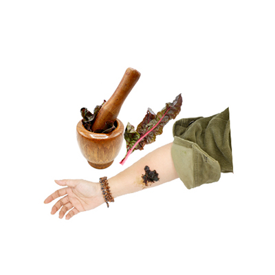 Ramuan tradisional Menghentikan pendarahan pada luka dari Rhubarb Chard Swiss