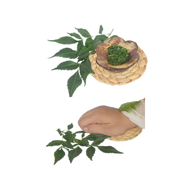 Ramuan tradisional Kudis dari Mindi Kecil