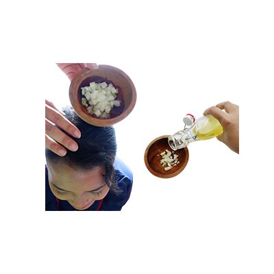 Ramuan tradisional Merangsang pertumbuhan rambut dari Bawang Bombai