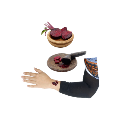 Ramuan tradisional Bisul dari Bit