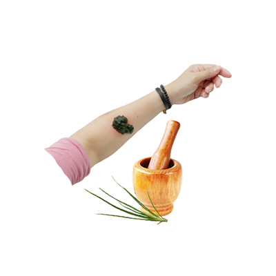 Ramuan tradisional Luka bakar dari Bulbine frutescens