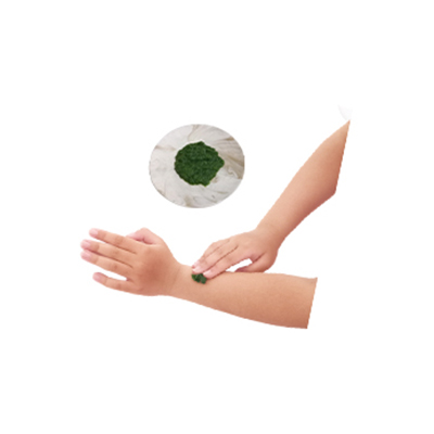 Ramuan tradisional Obat gatal dari Ki Jogo